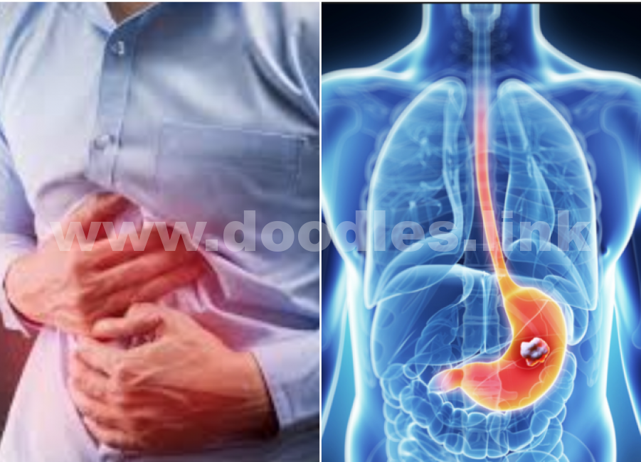 Gastropanel è Tumore Allo Stomaco Gli 8 campanelli d'allarme del cancro allo stomaco